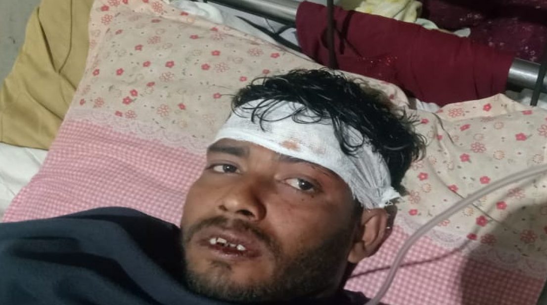 জামায়াতের কর্মীকে পিটিয়ে দাঁত ভেঙে দিল ছাত্রলীগের নেতাকর্মীরা